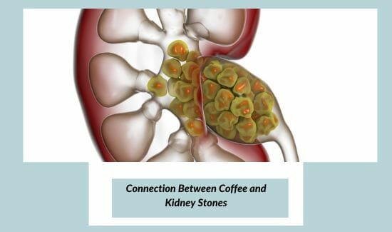 Connection Between Coffee and Kidney Stones